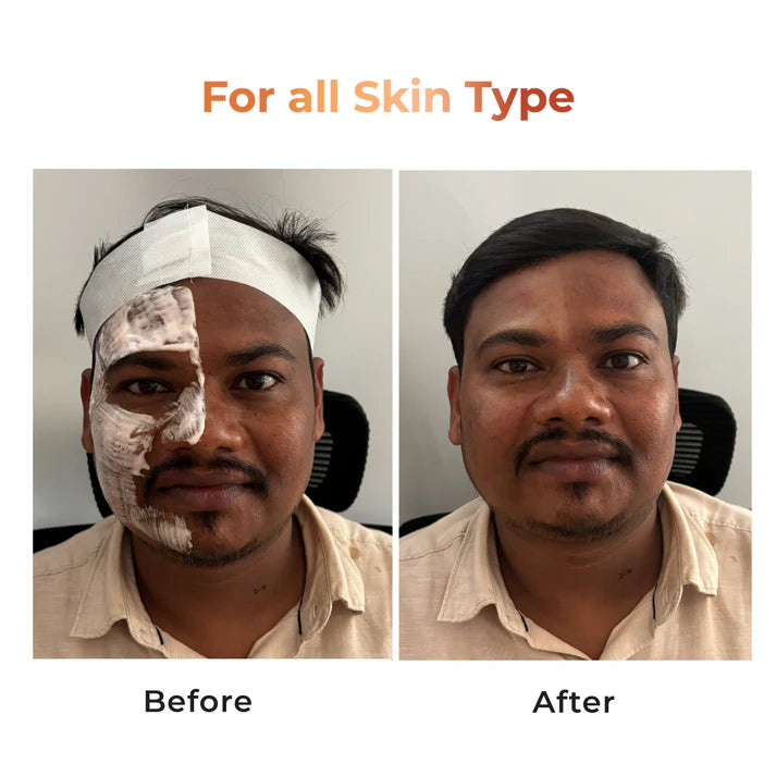 Niconi Tan Vanish Gluta-Kojic Skin Polish 180g (₹80 per use)