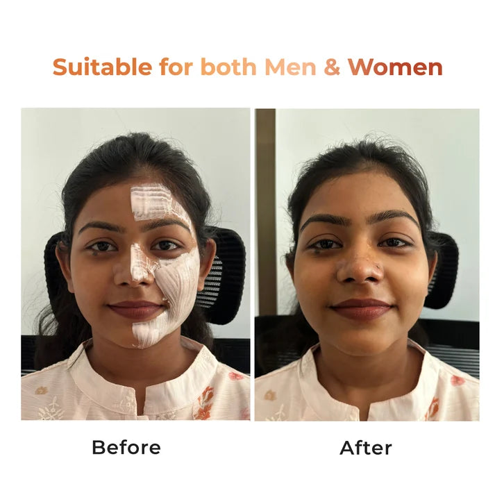 Niconi Tan Vanish Gluta-Kojic Skin Polish 180g (₹80 per use)